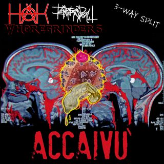 A dripping condom on top of an HIV virus on top of X-rays of a brain